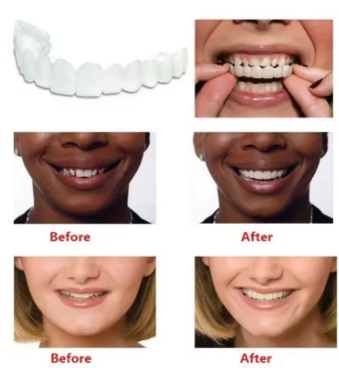 Perfect Fit Teeth Whitening Fake Tooth Cover Snap on Silicone Smile Veneers Teeth Flexibles Fake Teeth Dental Whitening Devices