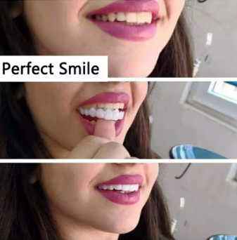 Perfect Fit Teeth Whitening Fake Tooth Cover Snap on Silicone Smile Veneers Teeth Flexibles Fake Teeth Dental Whitening Devices