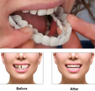 Perfect Fit Teeth Whitening Fake Tooth Cover Snap on Silicone Smile Veneers Teeth Flexibles Fake Teeth Dental Whitening Devices