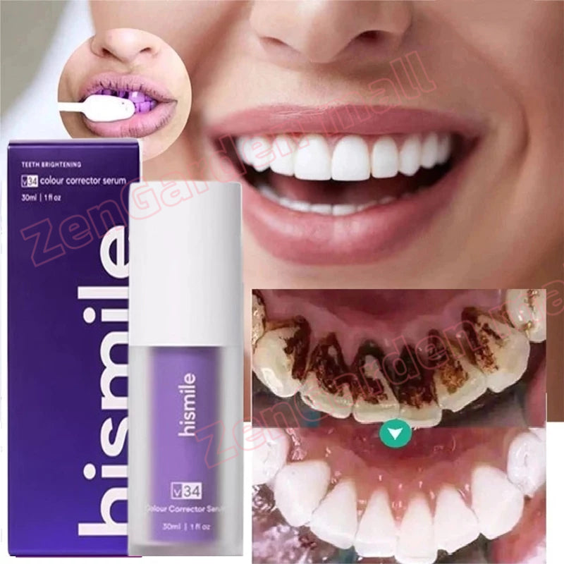 Hismile v34 Toothpaste teeth whitening serum هيسمايل معجون الأسنان سيرم الأصلي